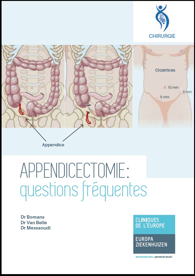 Appendicectomie