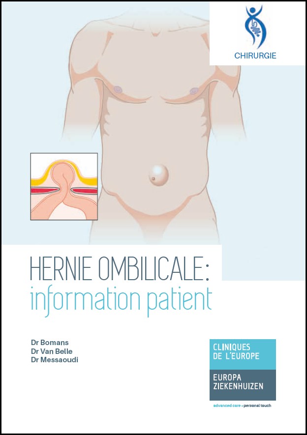 Hernie ombilicale